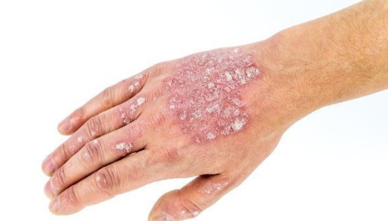 Quality Dermatology Care in Irvine and Costa Mesa, CA