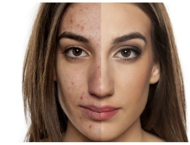 Finding the Best Aesthetic Care in Orange California Finding the Best Aesthetic Care in Orange California